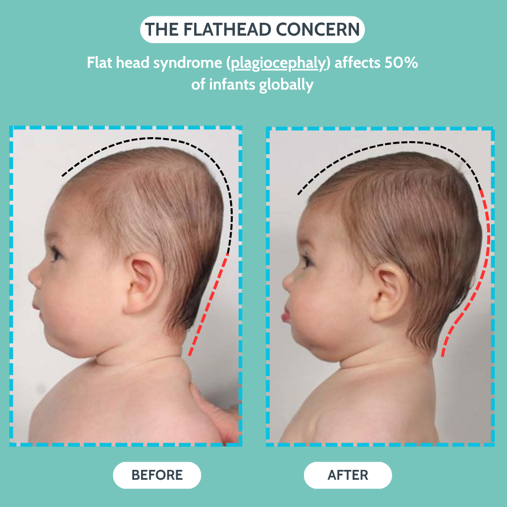 CradleCare™ - India's Most Trusted Baby Apparel
